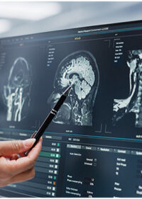 Life Care Planning in Traumatic Brain Injury Cases_FedBar