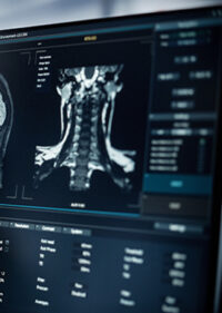 Plaintiff–Defense Brain Injury Litigation and the Measurement of Functional Loss: Medical Foundations, Expert Evidence, Trial Strategies - Live Video Broadcast