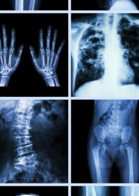 High-Stakes Orthopedic Injury Claims: IME Strategy, Healthcare Liability, and Exposure Control (2026 Edition) - On-Demand Video