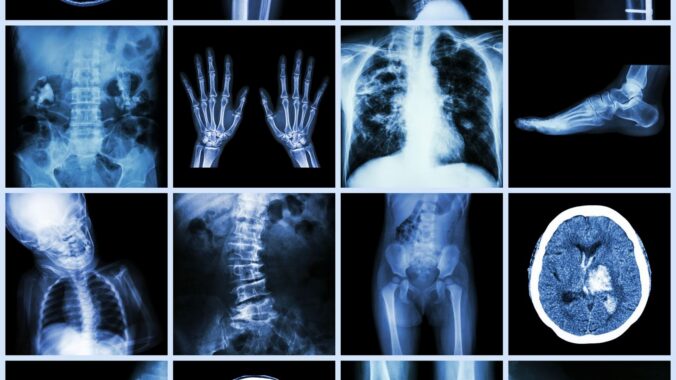 High-Stakes Orthopedic Injury Claims: IME Strategy, Healthcare Liability, and Exposure Control (2026 Edition)